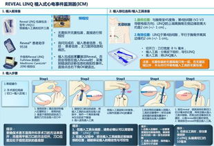 植入式心電事件監(jiān)測器的臨床應用推廣——以北京市衛(wèi)生科技成果推廣項目為例
